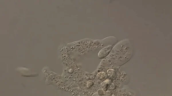アメーバが偽足を伸ばして他の微生物を包み込むように捕食する顕微鏡映像